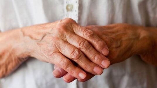 Rheumatoid arthritis can cause pain and swelling in the finger joints. 