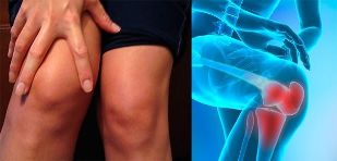 Knee joint discomfort and swelling are the first symptoms of arthropathy