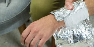 What are the methods of treatment of the joints in tin foil